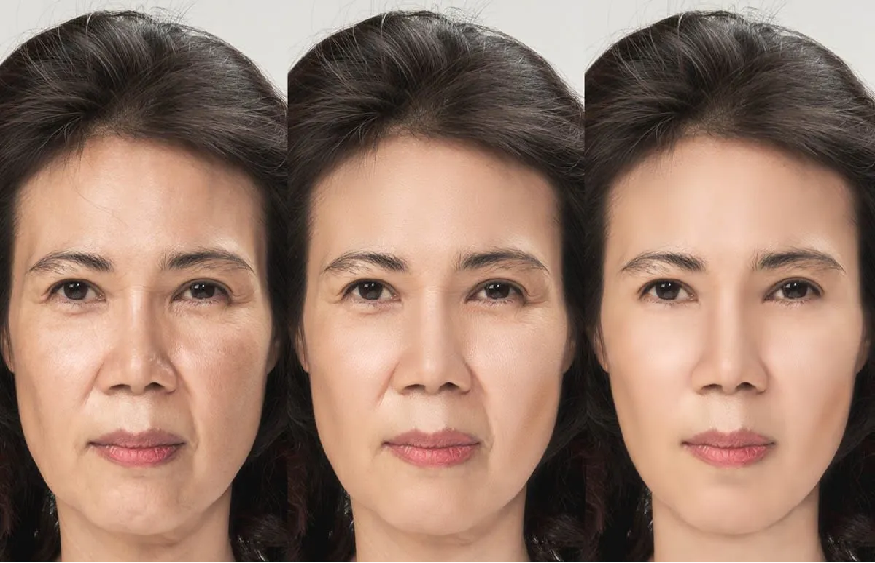 A Guide to HIFU Facials
