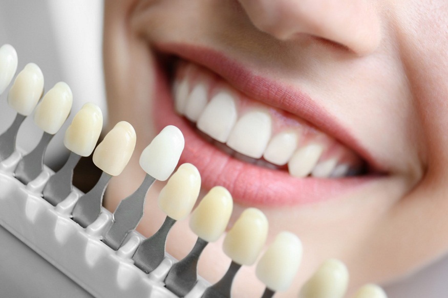 Dental implants in Philadelphia